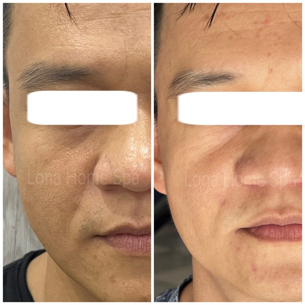 Trong phân tích da liễu, babe cho thấy hiệu quả vượt trội khi từ khóa chính được áp dụng một cách chuẩn xác để duy trì sắc đẹp và sức khỏe làn da.