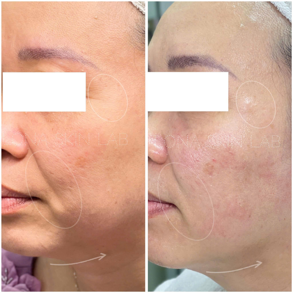 Niacinamide Juliette Armand, serum BHA Obagi, cách sử dụng Niacinamide và BHA, thứ tự thoa Niacinamide và BHA, kết hợp Niacinamide và BHA