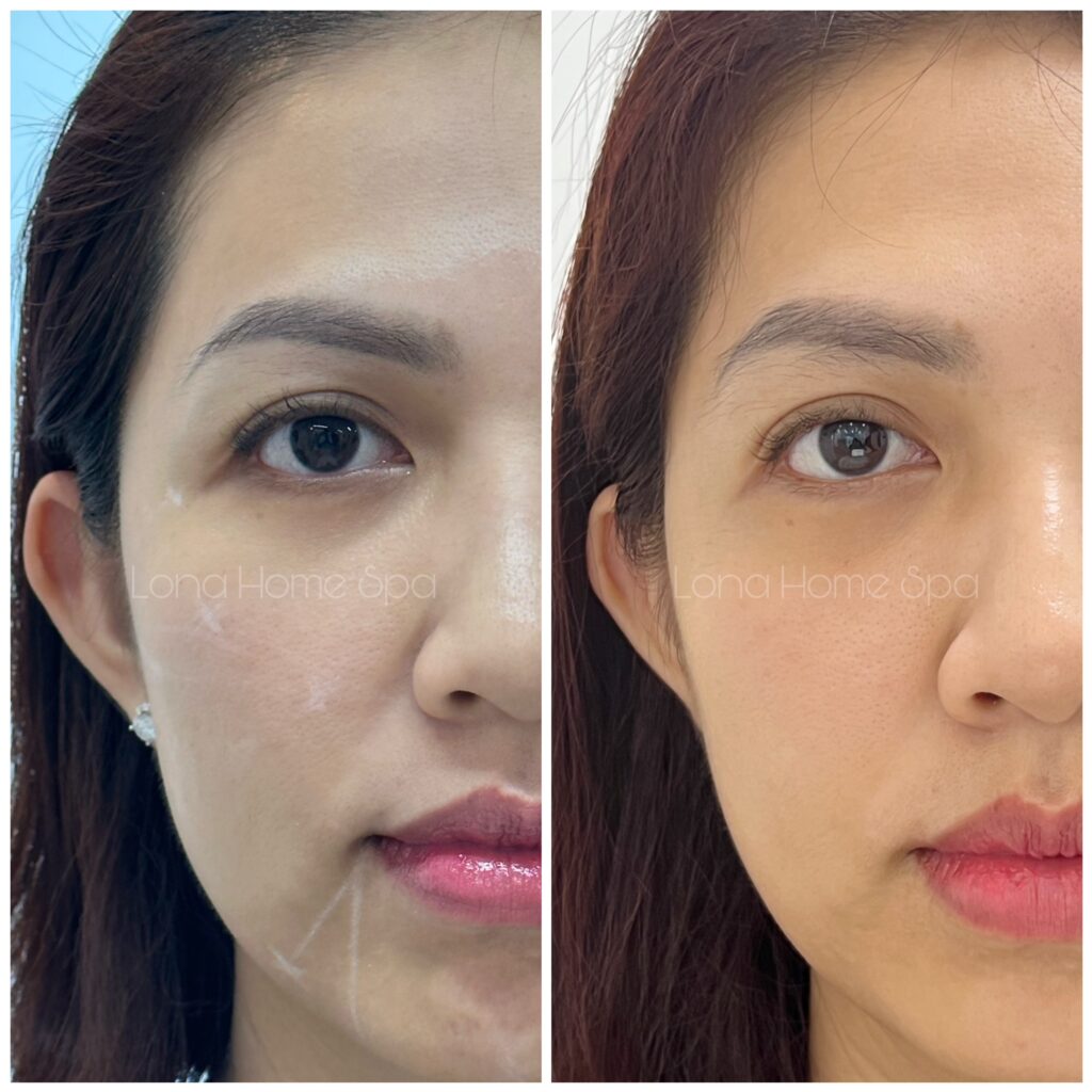 chống lão hóa thế hệ mới, tái sinh sinh học, phục hồi tế bào da, trị lão hóa đa tầng, điều hòa miễn dịch,