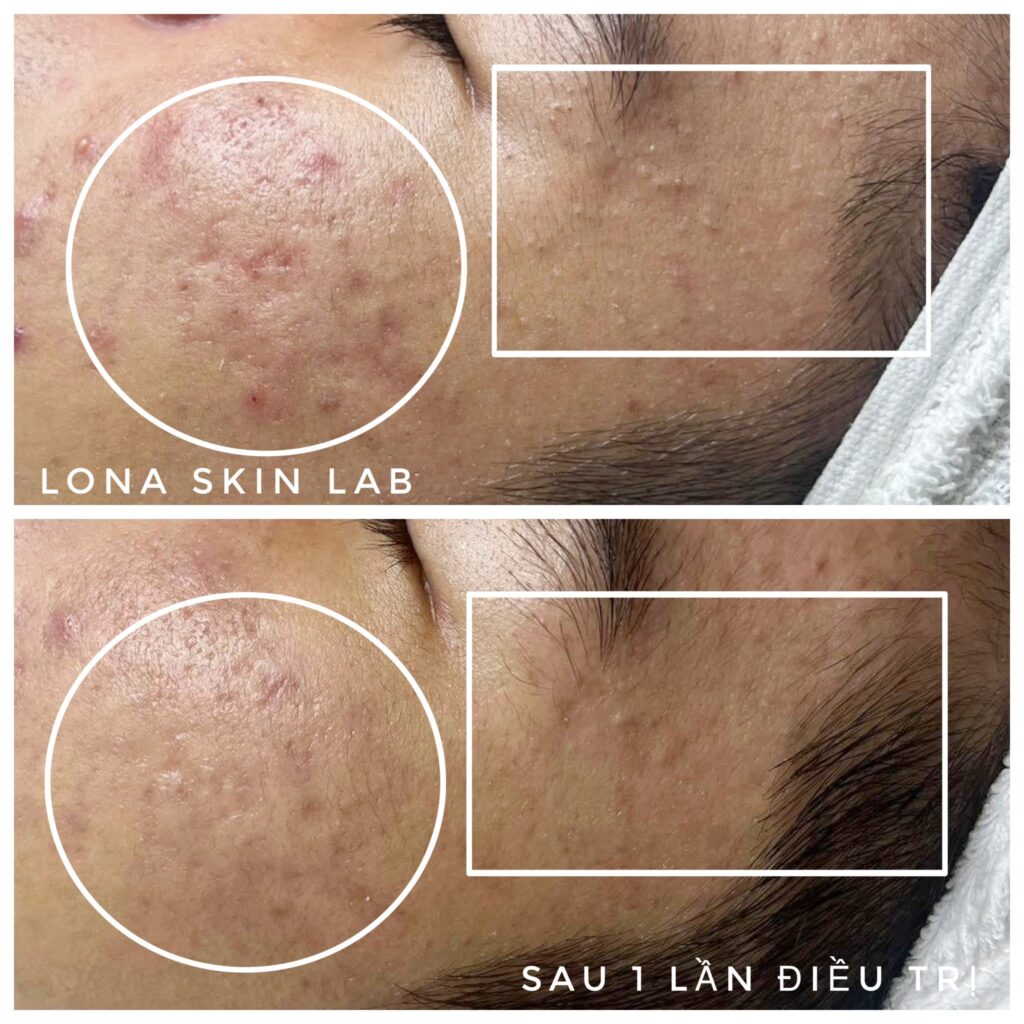 Kết quả chăm sóc da với Arginine Juliette Armand mang lại làn da rạng rỡ
