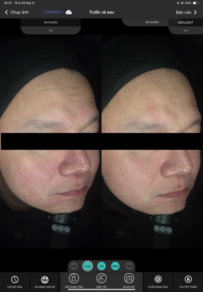 mặt nạ tightening Juliette Armand, mặt nạ nâng cơ Juliette Armand, mặt nạ phục hồi da sau HIFU, mặt nạ dưỡng ẩm Juliette Armand, mặt nạ chống lão hóa Juliette Armand