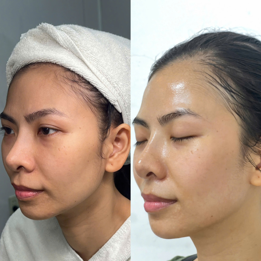 AiThan hiệu quả sau bao lâu, AiThan, hiệu quả AiThan, thời gian hiệu quả AiThan, cách sử dụng AiThan, đánh giá AiThan