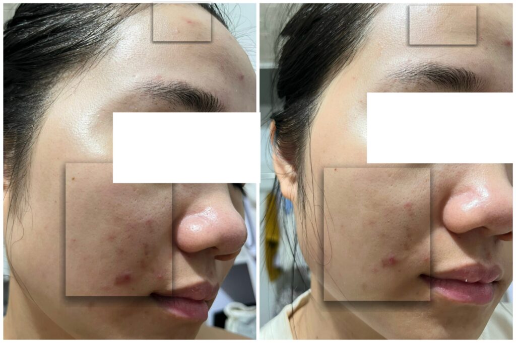 hồi phục da sau peel, Juliette Armand, chăm sóc da sau peel, phục hồi da bong tróc, dưỡng ẩm sau peel