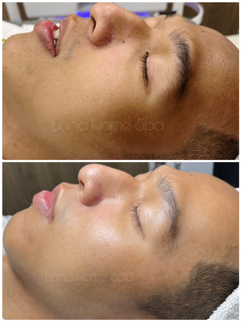 serum B9 Juliette Armand, Red Peel So’Natural, phục hồi da sau peel, tinh chất B9, chăm sóc da sau peel