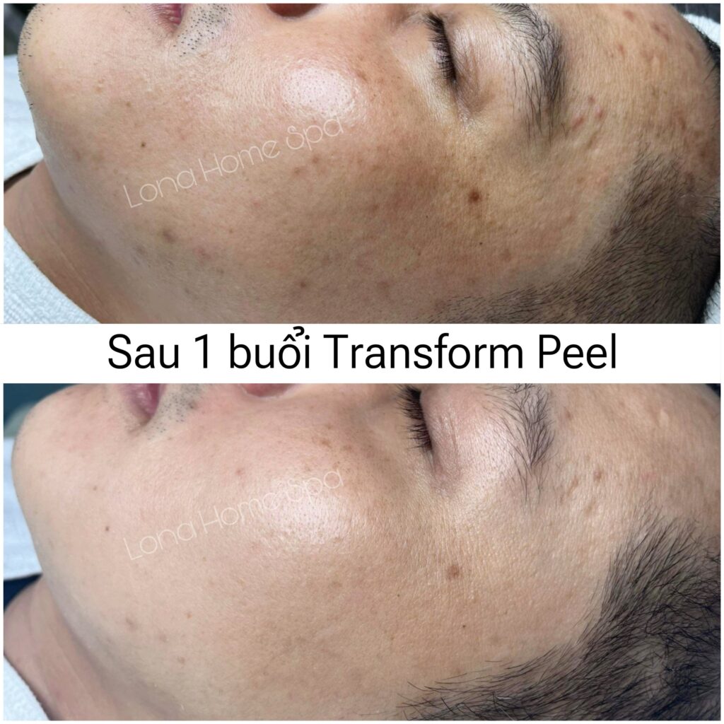 Tranexamic Acid Juliette Armand, Vitamin C Paula’s Choice, Kết hợp Tranexamic Acid và Vitamin C, Hiệu quả dưỡng da, Chăm sóc da sáng mịn