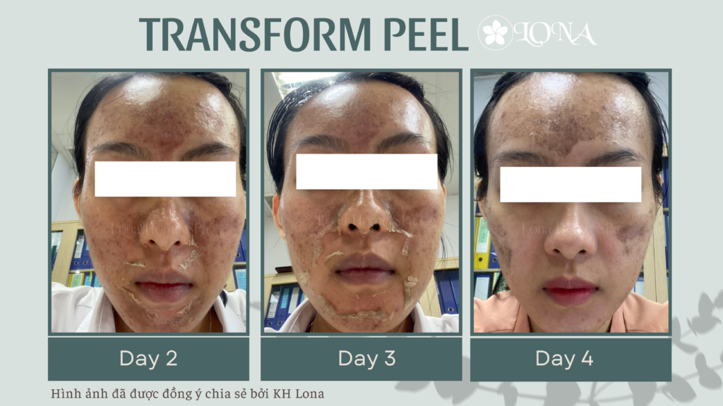 Tranexamic Acid Juliette Armand, Vitamin C Paula’s Choice, Kết hợp Tranexamic Acid và Vitamin C, Hiệu quả dưỡng da, Chăm sóc da sáng mịn