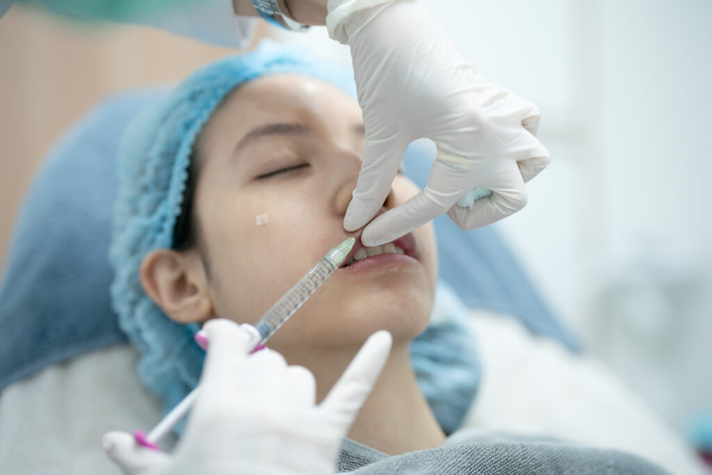 filler kết hợp filler da liễu, filler thông qua filler, filler tích hợp filler