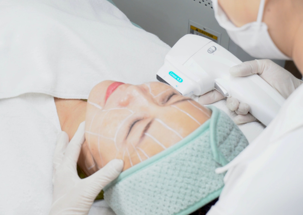 HIFU Cần Thơ, HIFU Cần Thơ, công nghệ trẻ hóa, trẻ hóa da không xâm lấn, nâng cơ mặt, lona.vn