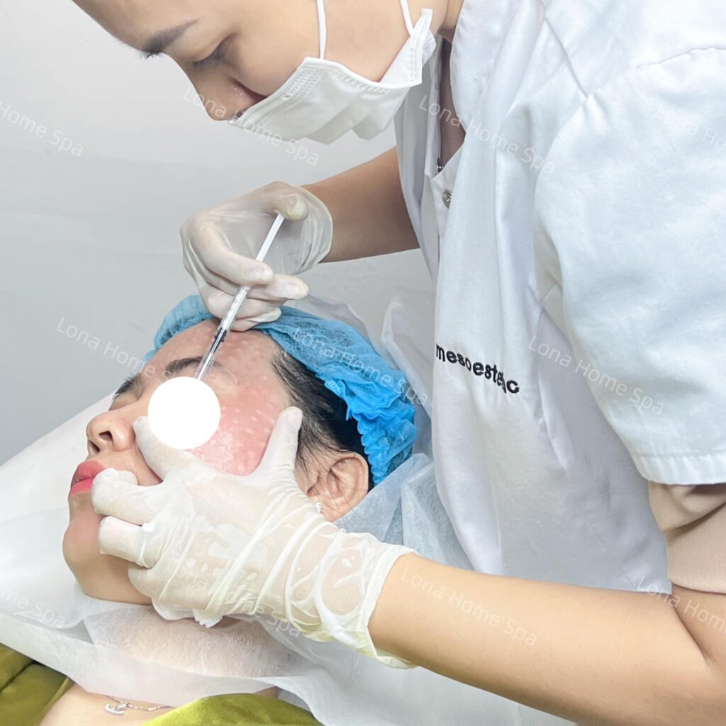 Hình ảnh thực hiện liệu pháp tiêm mesotherapy nuôi dưỡng và phục hồi da – Từ khóa gốc: meso, meso16.jpg.