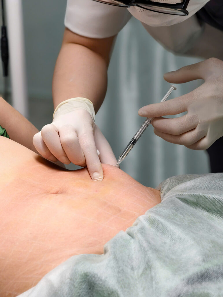 Qua Meso BAP chuyên sâu của lona.vn, bác sĩ sẽ Chọn Meso BAP phù hợp và Chọn Meso BAP cá nhân hóa, giúp trẻ hóa da và kích hoạt quá trình tái sinh mặt hiệu quả.