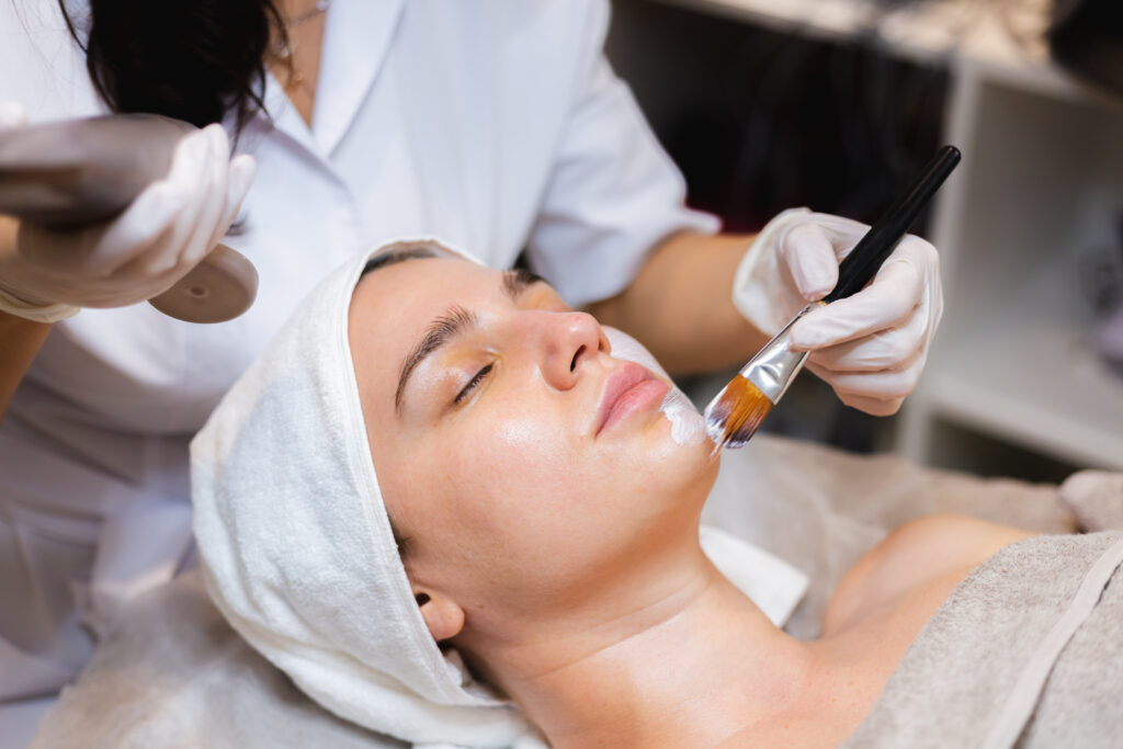 ISOV Meso Peel, peel da, ISOV Meso Peel, hiệu quả peel da, tái tạo da, trị mụn