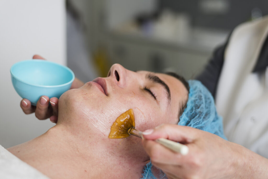 ISOV sau peel, peel da xong nên dùng gì, chăm sóc da sau peel, sản phẩm dưỡng da sau peel, phục hồi da sau peel, ISOV chăm sóc da