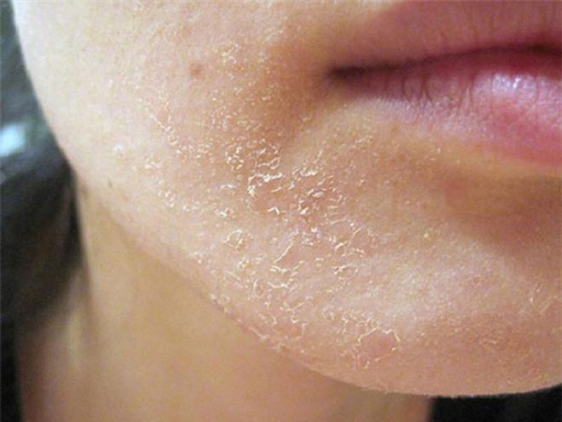 Sản phẩm chăm sóc da hỗ trợ glow skin là gì và mang lại làn da rạng rỡ tự nhiên cho người dùng