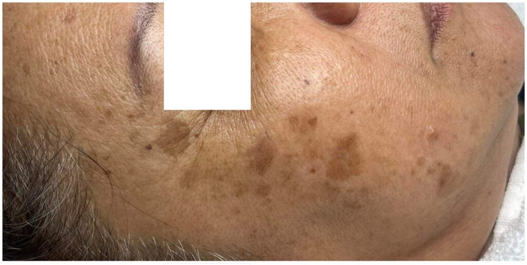 Công nghệ LED ánh sáng đỏ cùng glow skin là gì giúp duy trì làn da rạng rỡ và sức khoẻ của da