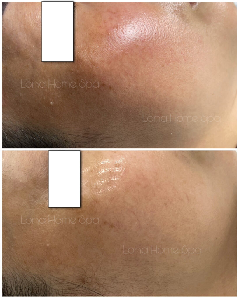 Ảnh minh họa Avorio: trong quy trình chăm sóc da, Avorio và mỹ phẩm Avorio với triết lý skincare tối giản từ Lona Skin Lab luôn đảm bảo an toàn da, khẳng định vai trò quan trọng của Avorio.
