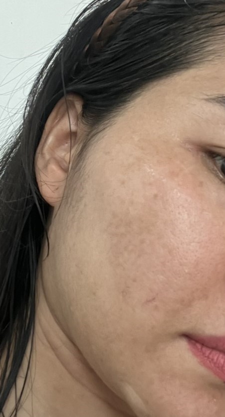 Hình ảnh Avorio trực quan cho thấy mỹ phẩm Avorio được phát triển theo phong cách skincare tối giản tại Lona Skin Lab, mang lại an toàn da cao và giúp Avorio nâng cấp hiệu quả điều trị da.