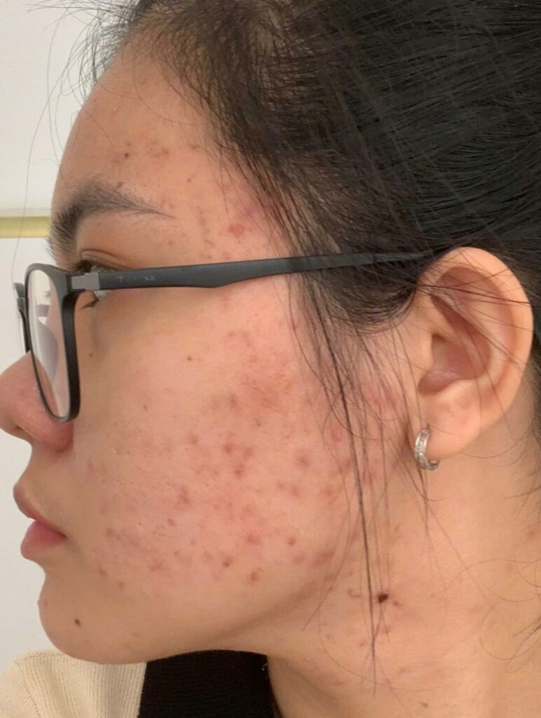 Ảnh chụp Avorio này chứng minh mỹ phẩm Avorio theo xu hướng skincare tối giản tại Lona Skin Lab không chỉ tạo nên sự hài hòa mà còn đảm bảo an toàn da, khẳng định giá trị của Avorio trong chăm sóc da chuyên sâu.