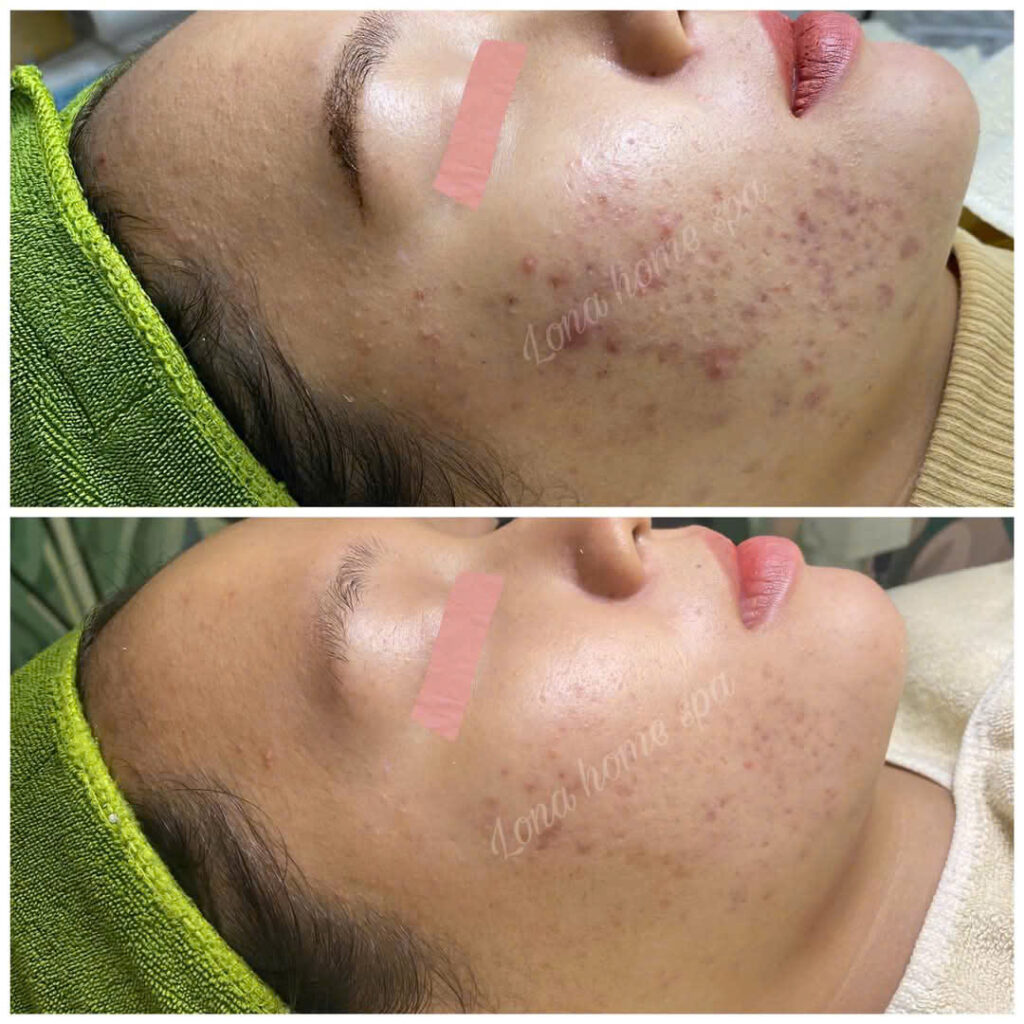 Bức ảnh Avorio thể hiện quy trình sử dụng mỹ phẩm Avorio với chiến lược skincare tối giản từ Lona Skin Lab, góp phần bảo vệ an toàn da và khẳng định vị thế của Avorio trên thị trường.
