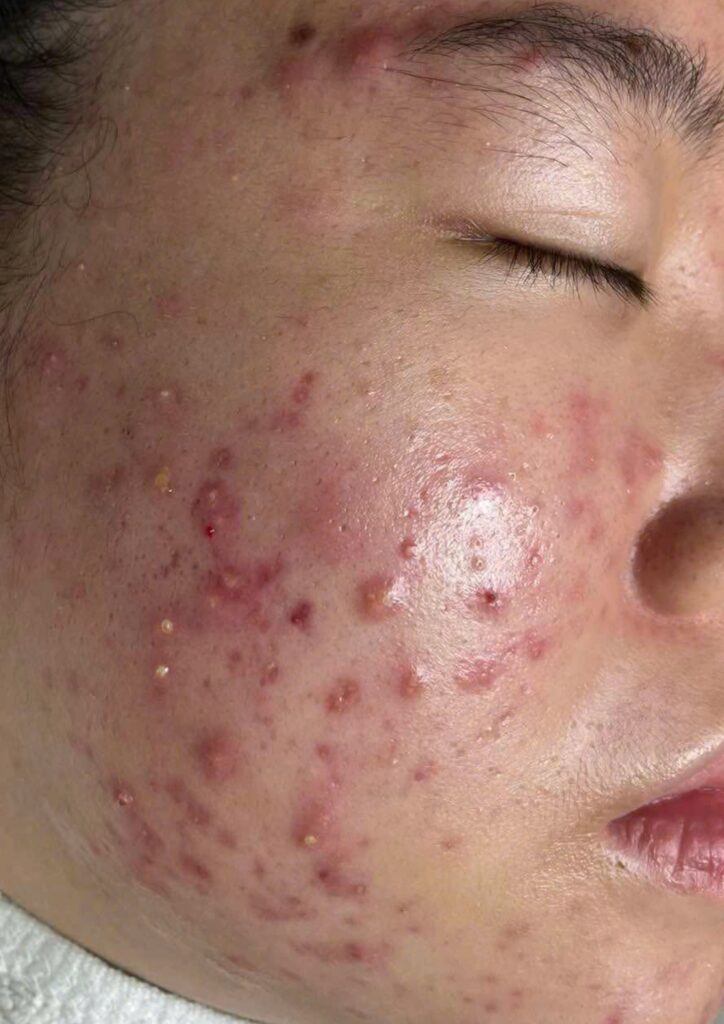Với sự nghiên cứu từ khóa chuyên sâu, BABE cùng từ khóa phụ khẳng định vai trò quan trọng trong chiến lược chăm sóc da và cải thiện kết cấu da.