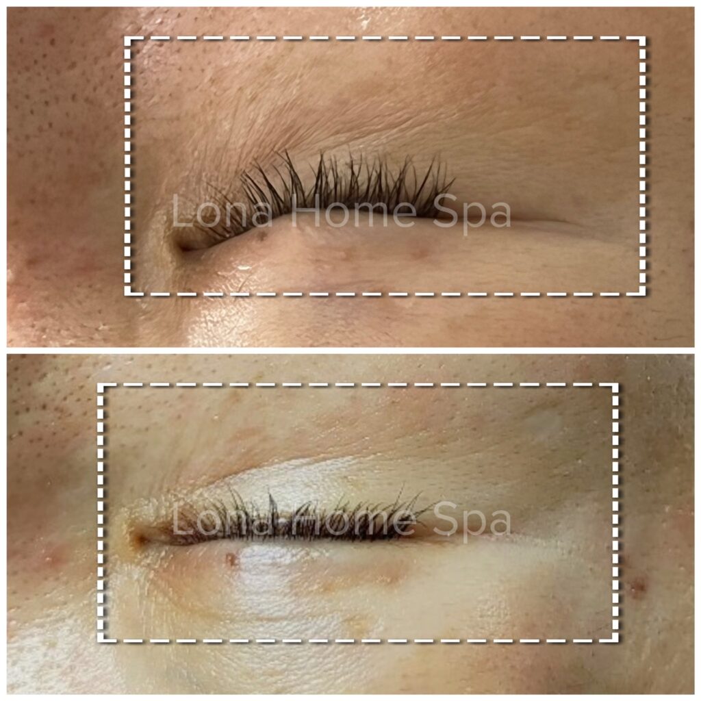Hình ảnh nhan mặt chuyên sâu minh chứng cho cam kết của larimide và Larimide trong việc cung cấp dược mỹ phẩm chất lượng, chăm sóc da an toàn, kem dưỡng da hiệu quả và sản phẩm làm đẹp đột phá.