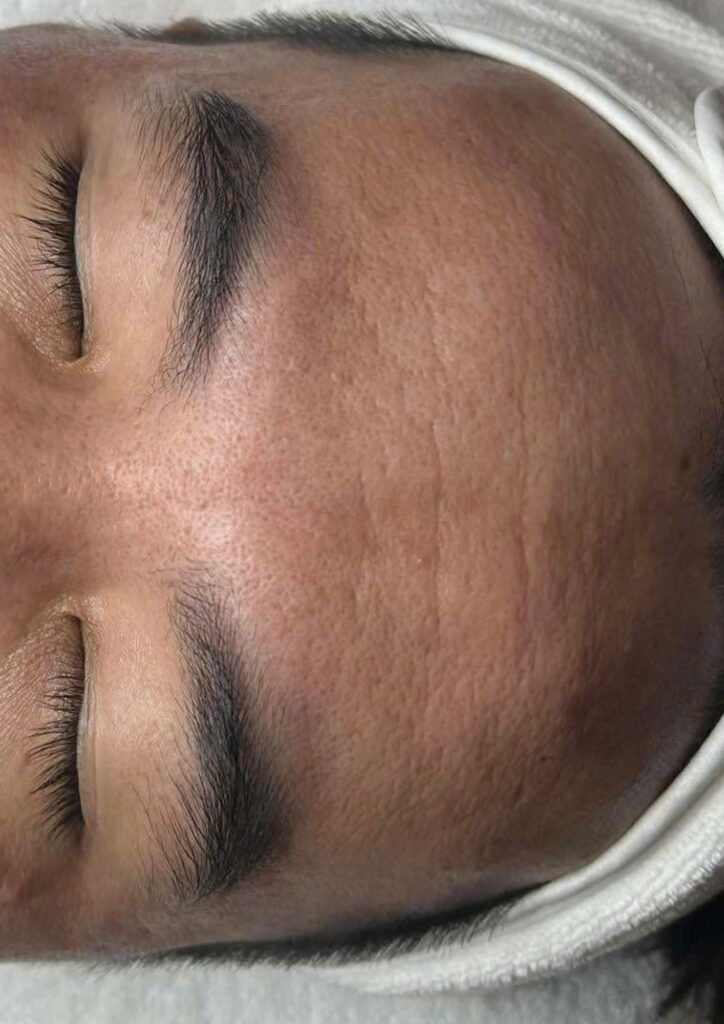 lão hóa da toàn mặt, lão hóa da, da toàn mặt, trị lão hóa, điều trị lão hóa toàn diện, Lona Skin Lab