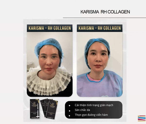 Hình ảnh trước và sau thực tế của bệnh nhân