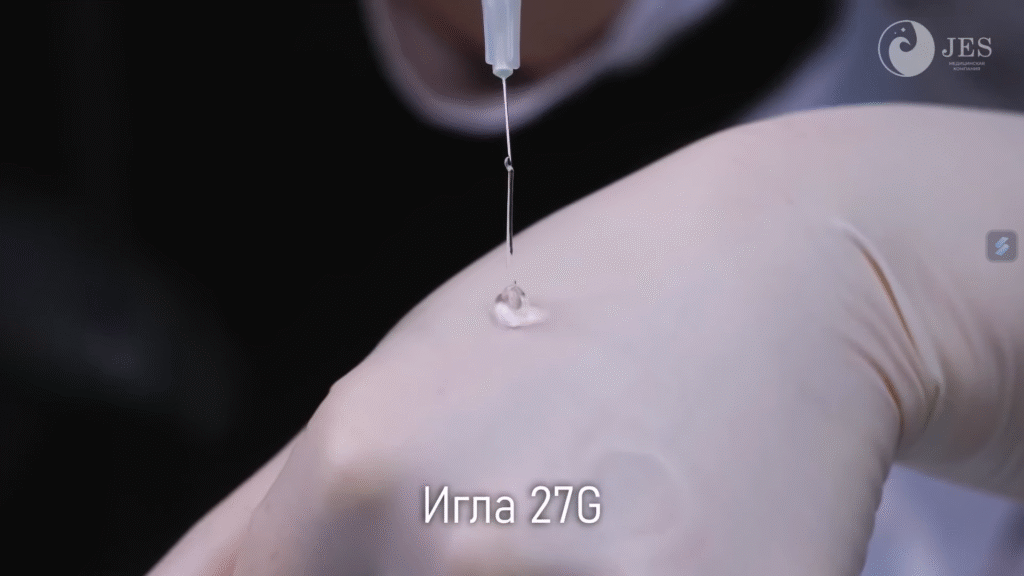 Tiêm Karisma phục hồi nền da mỏng với kỹ thuật sử dụng kim 27G tinh vi đảm bảo độ an toàn tối đa và hiệu quả lâu dài trong việc kích thích tái tạo ECM và cải thiện sức khỏe da.