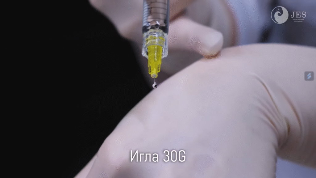 Hình ảnh về bác sĩ thực hành tiêm Karisma cho thấy sự an toàn và kiểm duyệt kỹ thuật, minh họa rằng Karisma là gì từ góc độ chuyên môn y khoa.
