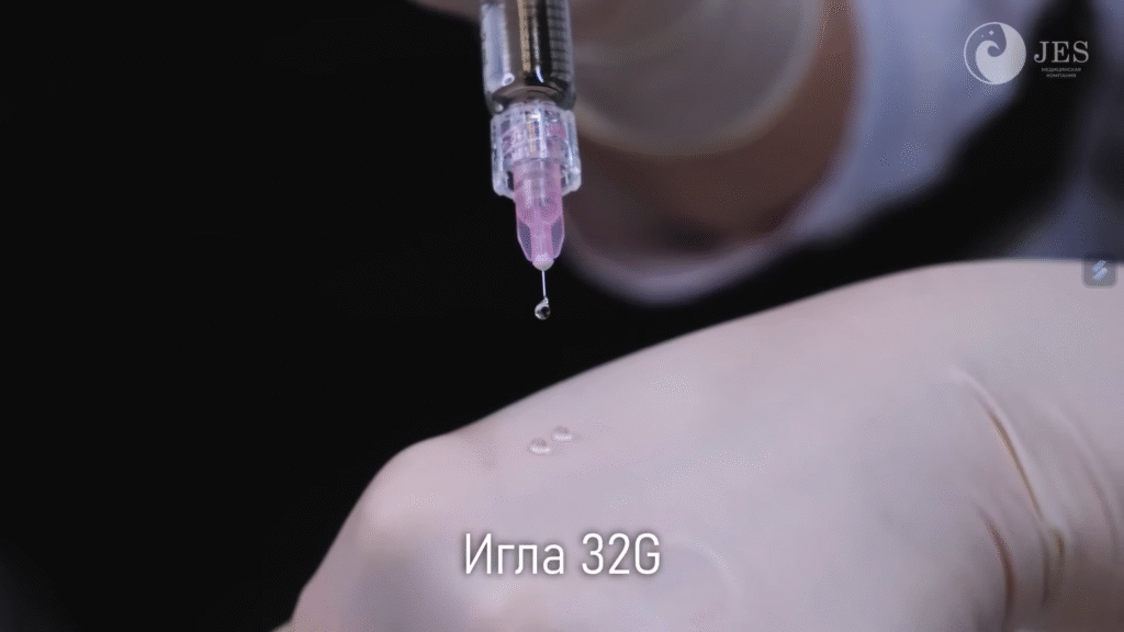 Những lưu ý khi dùng Karisma được áp dụng qua việc sử dụng kim 32G, đảm bảo kỹ thuật tiêm chính xác và an toàn, giúp tăng hiệu quả điều trị da một cách tối ưu.